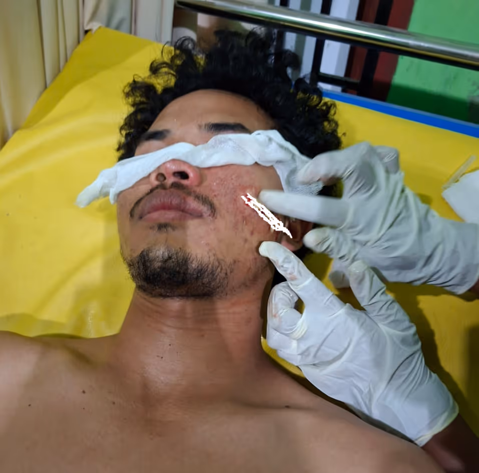 Polisi yang terluka