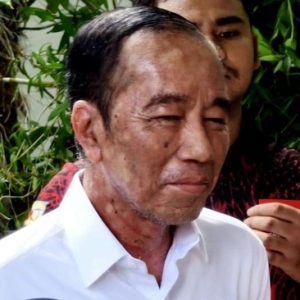 Penampakan kondisi kulit Jokowi